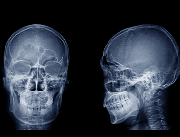 脳へのダメージを吸収のイメージ写真