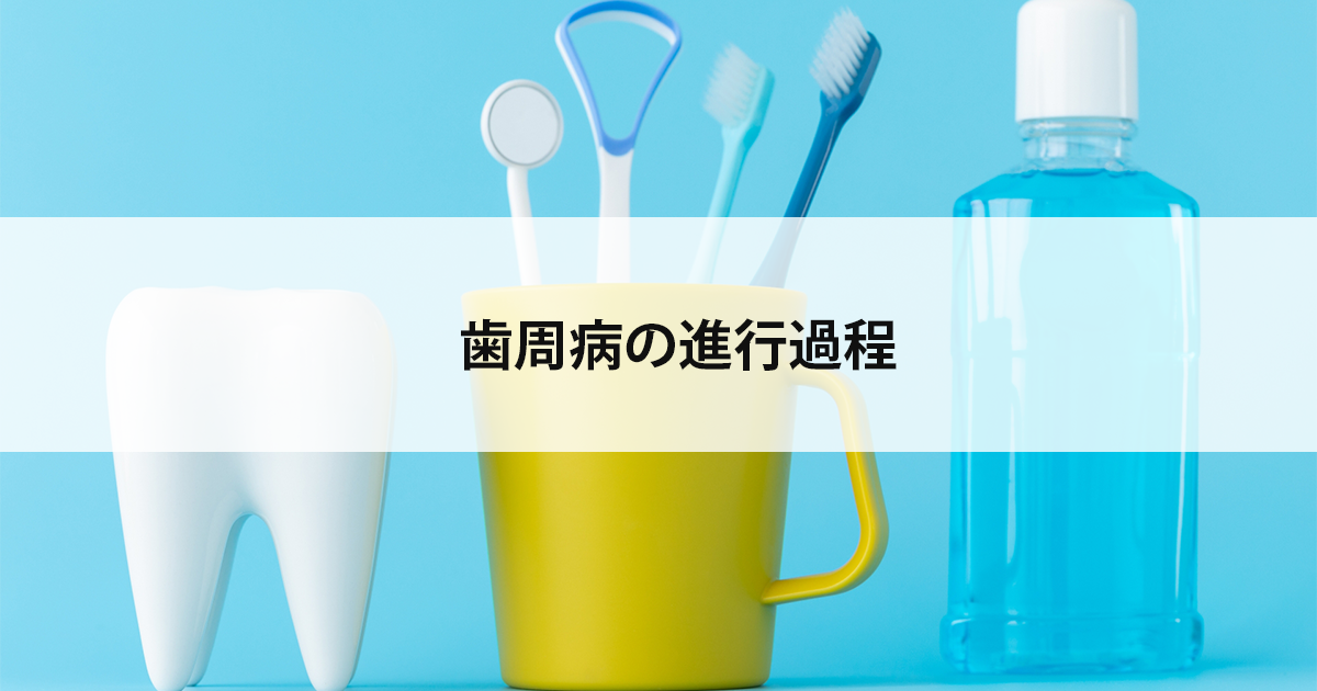 【新潟の歯医者】歯周病の進行過程