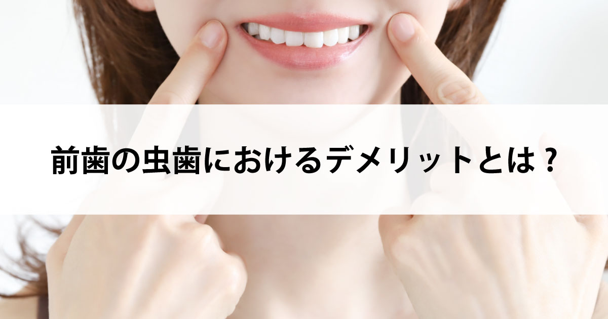 【新潟の歯医者で虫歯治療】前歯の虫歯におけるデメリットとは?